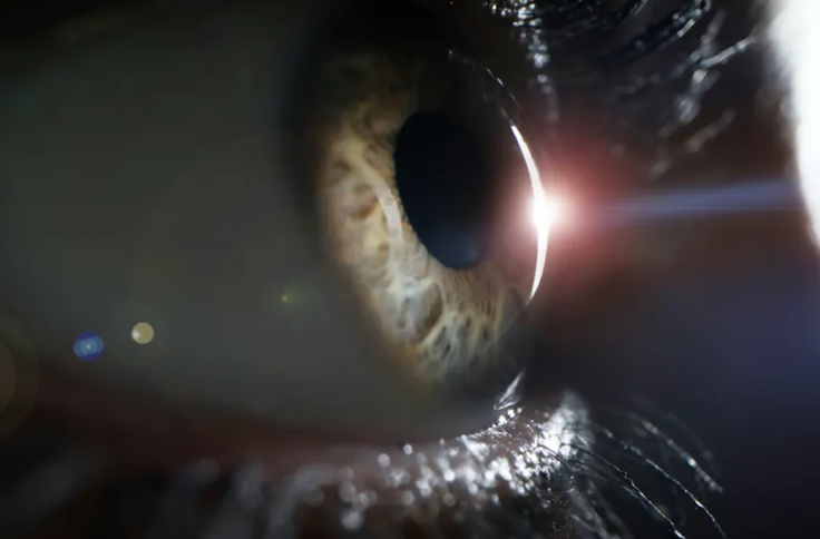 پیشرفتی در راستای درمان نابینایی برپایه‌ی سلول بنیادی